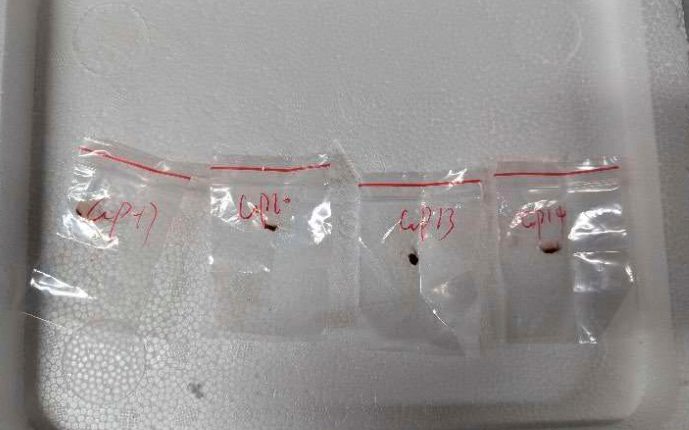 Chinese scientist faces hearing after pathogen seized by FBI