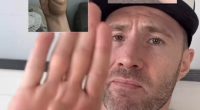 Doctor reveals the simple thumb test that can show a 'ticking time bomb' heart problem