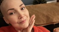 Doctors dismissed my common 'hormonal' problem...it was actually stage 4 cancer that's spread to my brain