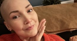 Doctors dismissed my common 'hormonal' problem...it was actually stage 4 cancer that's spread to my brain