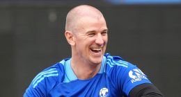 Former England goalkeeper Joe Hart sports fresh scars of hair transplant at Soccer Aid... in a far cry from his days in Head and Shoulders adverts!
