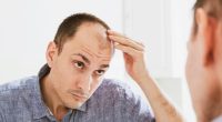 Good news for bald men! Scientists have developed a simple way to reverse hair loss - and say a treatment could be available by 2029