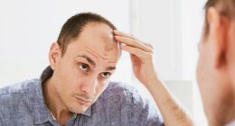 Good news for bald men! Scientists have developed a simple way to reverse hair loss - and say a treatment could be available by 2029