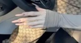 Shocking rise of 'Ozempic HANDS': New disturbing side effect of weight-loss jab leaving celebrities looking 'like the undead'