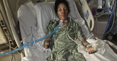 Terrified mom wakes up with all of her limbs amputated after catching two common infections at the same time