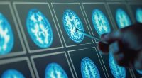 Top scientists flag little-known earliest signs of dementia that have nothing to do with memory