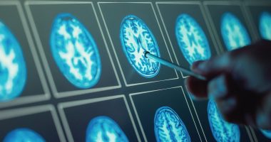 Top scientists flag little-known earliest signs of dementia that have nothing to do with memory