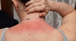 Weird 1p period pad tip that can soothe sunburn pain