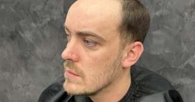 When I started balding in my teens I was so insecure. Then I discovered the hair-loss miracle men whisper about and it changed my life. No, it's NOT a transplant - you'll never guess my secret