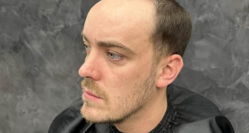 When I started balding in my teens I was so insecure. Then I discovered the hair-loss miracle men whisper about and it changed my life. No, it's NOT a transplant - you'll never guess my secret