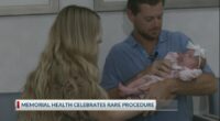 'Forever grateful': rare procedure performed at Memorial Health on July 1