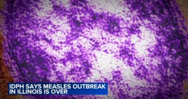 2025 Illinois measles cases: Health officials declare end of outbreak in southern Illinois