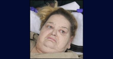 500-pound woman attacks EMTs taking her out of home: Cops