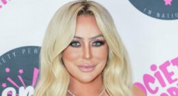 Aubrey O'Day REVERSES plastic surgery as she ditches lip fillers etc