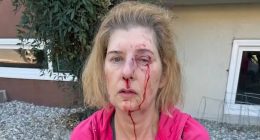 Distraught LA woman, 52, reveals horror of random homeless attack