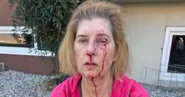 Distraught LA woman, 52, reveals horror of random homeless attack