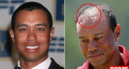 Doctor reveals rumored surgery Tiger Woods had that has failed TWICE