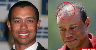 Doctor reveals rumored surgery Tiger Woods had that has failed TWICE