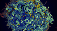 EU regulator approves injectable HIV drug that experts say could help stop transmission