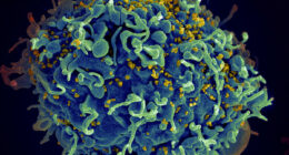 EU regulator approves injectable HIV drug that experts say could help stop transmission