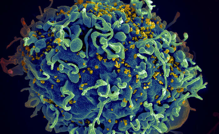 EU regulator approves injectable HIV drug that experts say could help stop transmission