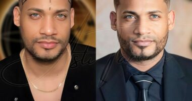 Hair transplants in the U.S. vs. Turkey