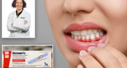 How to combat 'Ozempic mouth' and 'Ozempic teeth': dentist