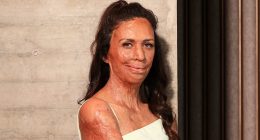 Inspirational burns survivor Turia Pitt reveals new career