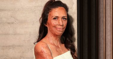 Inspirational burns survivor Turia Pitt reveals new career