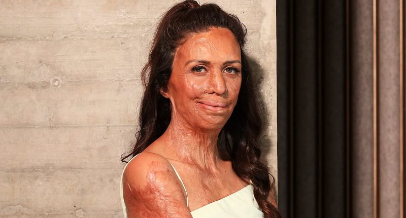 Inspirational burns survivor Turia Pitt reveals new career