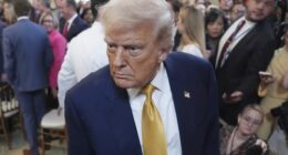 Is Trump's diagnosis benign? Everything to know about chronic venous insufficiency