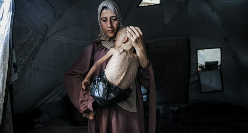 Malnourished child held by his mother in a tent.