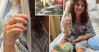 Jersey shore lifeguard impaled by umbrella is back at the beach