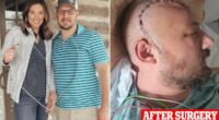 Man, 38, diagnosed with deadly brain cancer reveals symptoms
