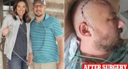 Man, 38, diagnosed with deadly brain cancer reveals symptoms