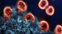HIV-1 Virus Particles Transmission electron micrograph of HIV-1 virus particles replicating from an HIV-infected H9 T-cell.