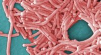One dead after outbreak of rare disease in Sydney
