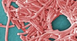 One dead after outbreak of rare disease in Sydney