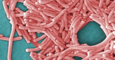 One dead after outbreak of rare disease in Sydney