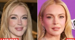 Plastic surgeons reveal the work Lindsay Lohan is rumored to have had