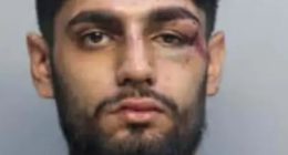 Mugshot of Ishaan Sharma with a black eye and other injuries.