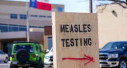 The US is having its worst year for measles in more than three decades