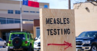 The US is having its worst year for measles in more than three decades