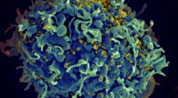 UN warns of millions of AIDS deaths after US funding cuts