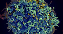 UN warns of millions of AIDS deaths after US funding cuts