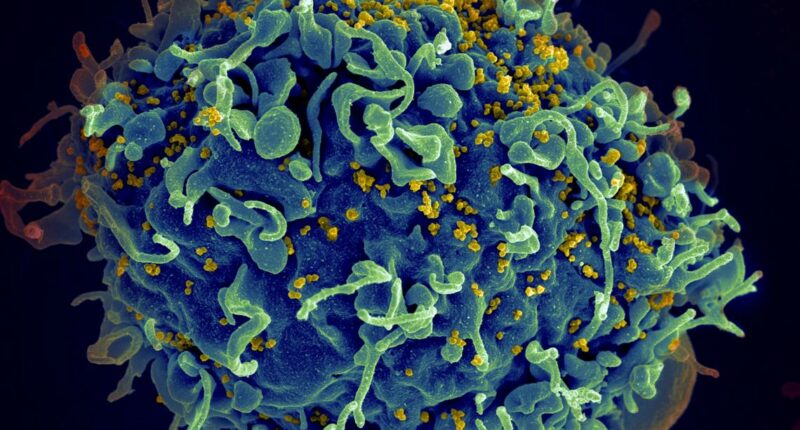 UN warns of millions of AIDS deaths after US funding cuts