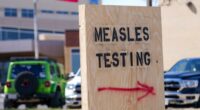 US measles outbreak breaks decadeslong record with new high