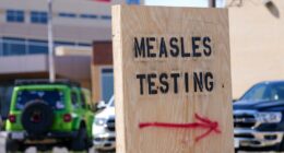 US measles outbreak breaks decadeslong record with new high