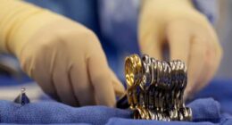 US organ donation system faces scrutiny and changes after reports of disturbing near-misses
