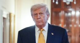 What is chronic venous insufficiency, Trump's diagnosis?
